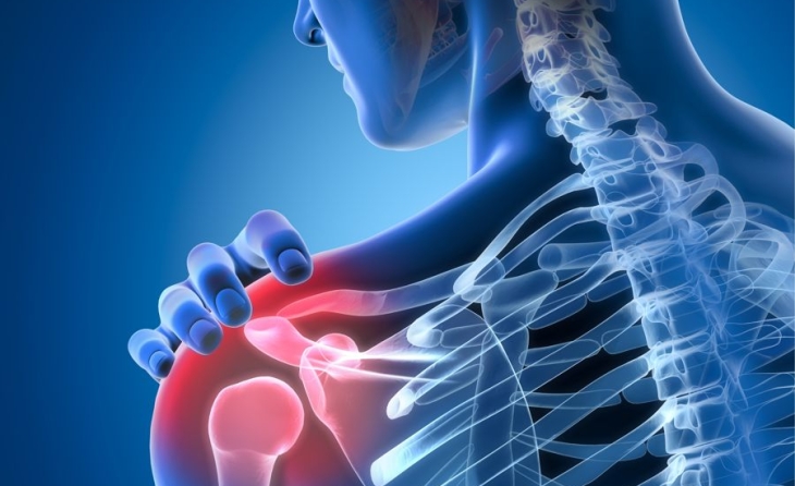 Παθήσεις ώμου